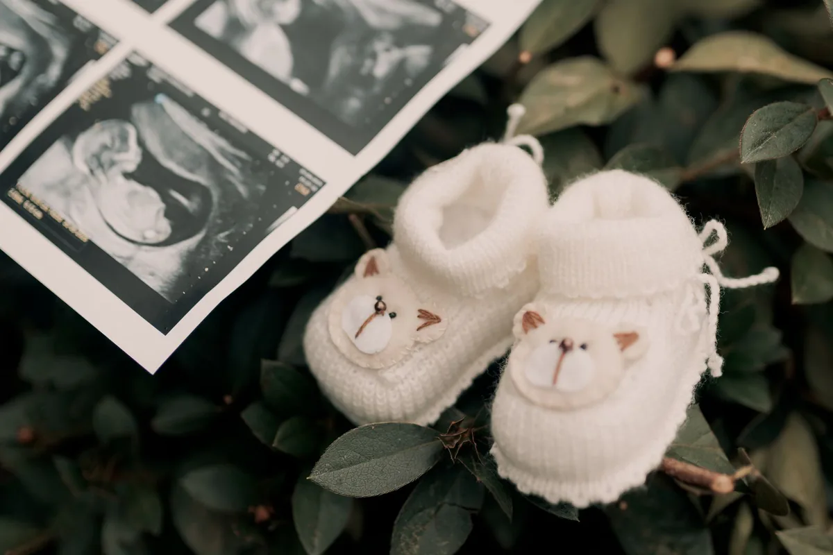 Ultraschallbilder und Babyschuhe zwischen grünen Zweigen